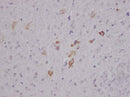 Anti-Human/Mouse/Rat Nesfatin-1/Nucleobindin-2 Antibody - ABMIUM