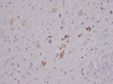 Anti-Human/Mouse/Rat Nesfatin-1/Nucleobindin-2 Antibody - ABMIUM