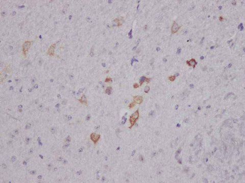 Anti-Human/Mouse/Rat Nesfatin-1/Nucleobindin-2 Antibody - ABMIUM