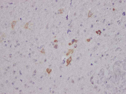 Anti-Human/Mouse/Rat Nesfatin-1/Nucleobindin-2 Antibody - ABMIUM