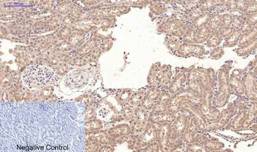 Anti-Human/Mouse/Rat CD10 Antibody [5B8]