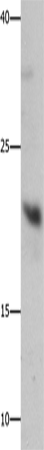 Anti-Human/Mouse/Rat GFER Antibody - ABMIUM