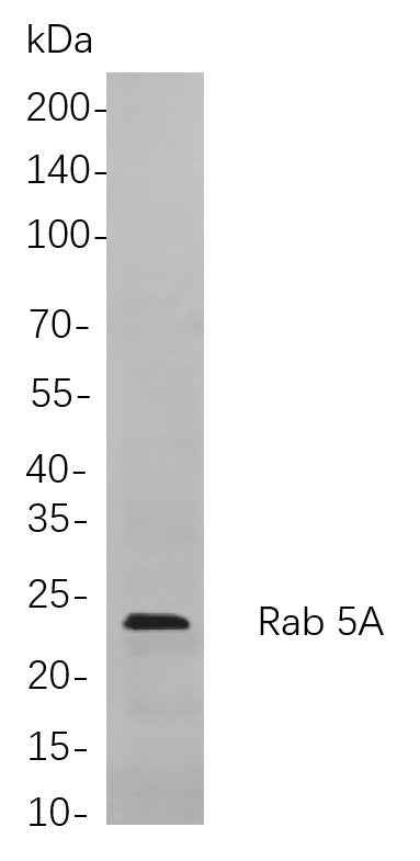 Anti-Human/Mouse/Rat Rab 5A Antibody [B755] - ABMIUM
