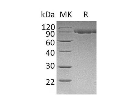 Recombinant Mouse Serpin G1/C1IN Protein (His Tag) - ABMIUM