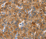 Anti-Human NOD2 Antibody - ABMIUM