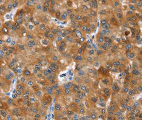 Anti-Human NOD2 Antibody
