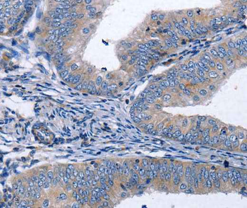 Anti-Human/Mouse/Rat BDNF Antibody
