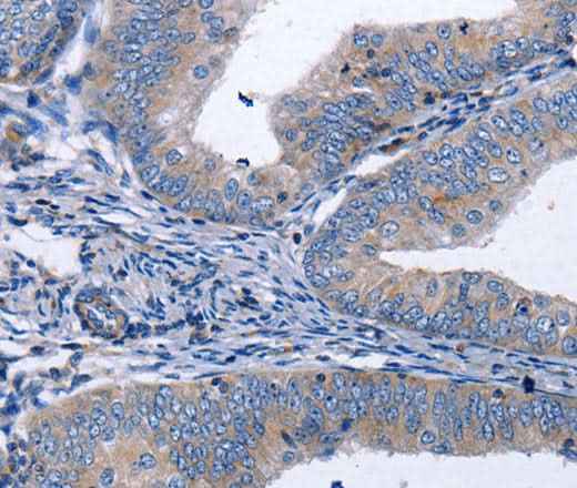 Anti-Human/Mouse/Rat BDNF Antibody
