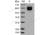 > 98 % as determined by reducing SDS-PAGE.