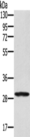 Anti-Human EDA2R Antibody - ABMIUM