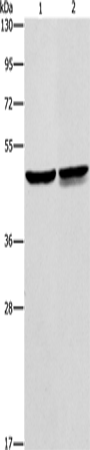 Anti-Human AMACR Antibody - ABMIUM