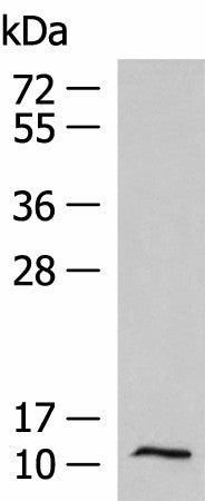 Western blot analysis of Human fetal liver tissue lysate using PCBD1 Polyclonal Antibody at dilution of 1:1000