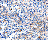 Anti-Human/Mouse/Rat GADD45G Antibody - ABMIUM