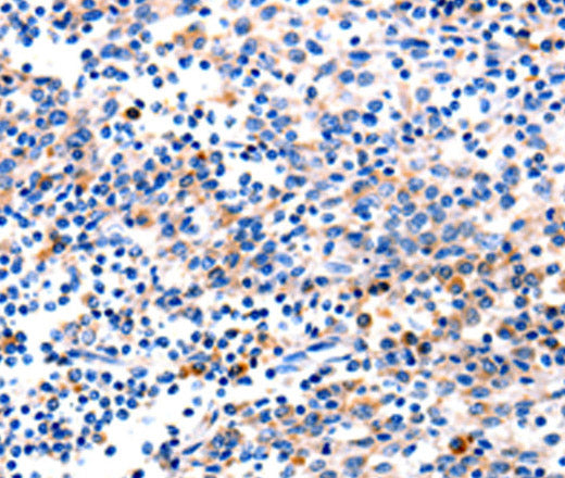 Anti-Human/Mouse/Rat GADD45G Antibody - ABMIUM
