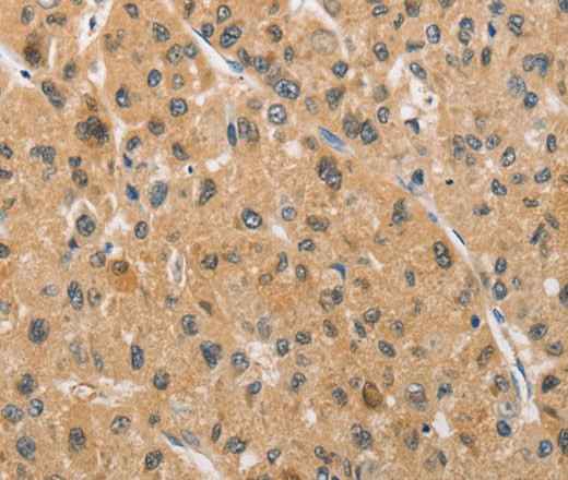 Anti-Human/Mouse/Rat ARMCX1 Antibody