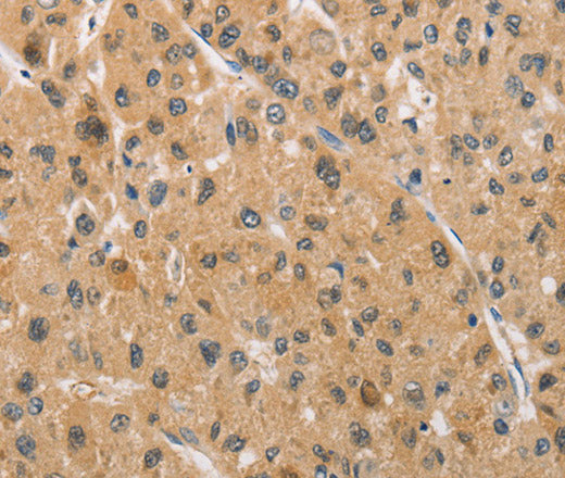 Anti-Human/Mouse/Rat ARMCX1 Antibody - ABMIUM