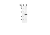 SDS-PAGE analysis of Mouse Ccl21a proteins, 2 μg/lane of Recombinant Mouse Ccl21a proteins was resolved with an SDS-PAGE under reducing conditions, showing bands at 32 kDa.