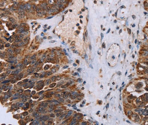 Anti-Human DDX11 Antibody - ABMIUM
