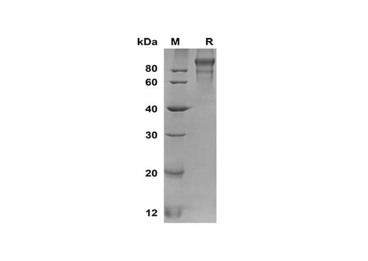 SDS-PAGE analysis of Human ANG2 proteins, 2 μg/lane of Recombinant Human ANG2 proteins was resolved with SDS-PAGE under reducing conditions, showing bands at 100-120 kDa.