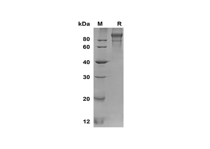 SDS-PAGE analysis of Human ANG2 proteins, 2 μg/lane of Recombinant Human ANG2 proteins was resolved with SDS-PAGE under reducing conditions, showing bands at 100-120 kDa.
