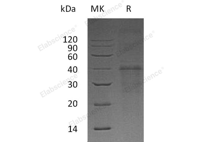 > 85 % as determined by reducing SDS-PAGE.