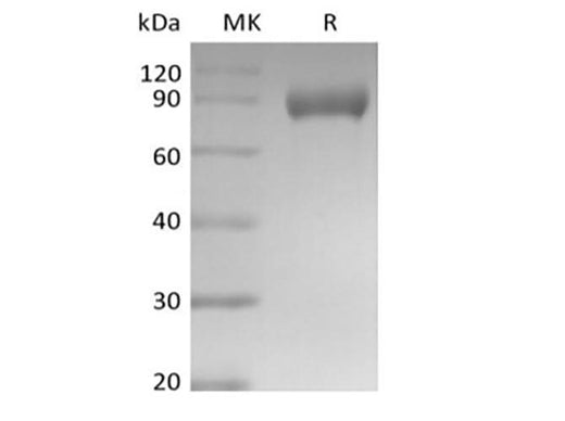 Recombinant Mouse Siglec-E (C-Fc) - ABMIUM