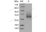 Recombinant Human CD147/Basigin Protein (His Tag) - ABMIUM