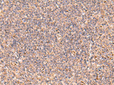 Immunohistochemistry of paraffin-embedded Human tonsil tissue using UBAC1 Polyclonal Antibody at dilution of 1:60(×200)