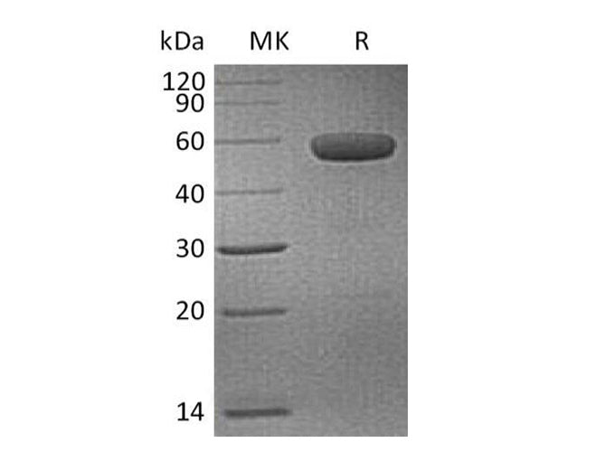 Recombinant Human CD40/TNFRSF5 Protein (mFc Tag) - ABMIUM