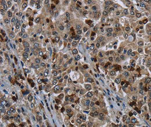 Anti-Human GP1BA Antibody