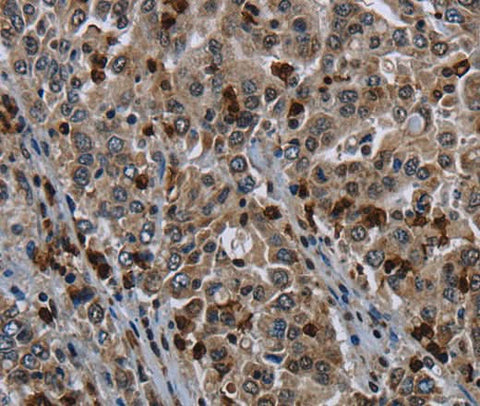 Anti-Human GP1BA Antibody - ABMIUM
