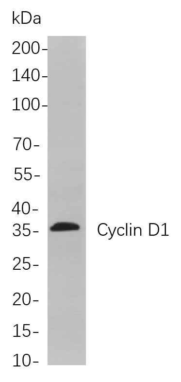 Anti-Human/Mouse/Rat Cyclin D1 Antibody [B779] - ABMIUM