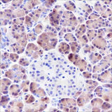 Anti-Human SPINK1 Antibody [A366]