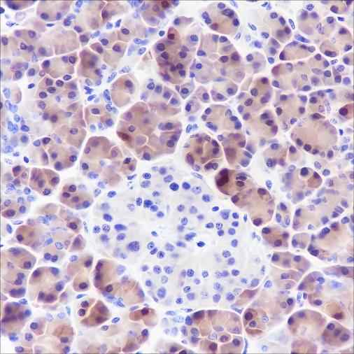 Anti-Human SPINK1 Antibody [A366]