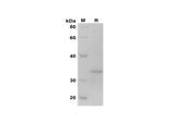 SDS-PAGE analysis of Human BAX proteins, 2 μg/lane of Recombinant Human BAX proteins was resolved with SDS-PAGE under reducing conditions, showing bands at 35 kDa.