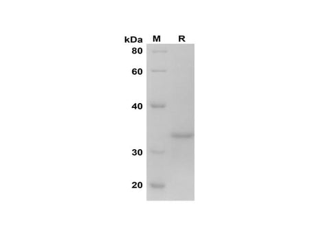 SDS-PAGE analysis of Human BAX proteins, 2 μg/lane of Recombinant Human BAX proteins was resolved with SDS-PAGE under reducing conditions, showing bands at 35 kDa.