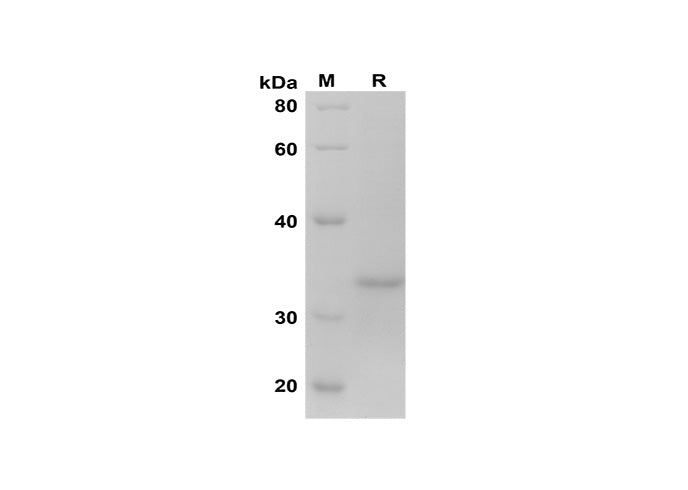 SDS-PAGE analysis of Human BAX proteins, 2 μg/lane of Recombinant Human BAX proteins was resolved with SDS-PAGE under reducing conditions, showing bands at 35 kDa.