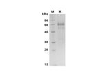 SDS-PAGE analysis of Human OLFM4 proteins, 2 μg/lane of Recombinant Human OLFM4 proteins was resolved with SDS-PAGE under reducing conditions, showing bands at 60-65 kDa.