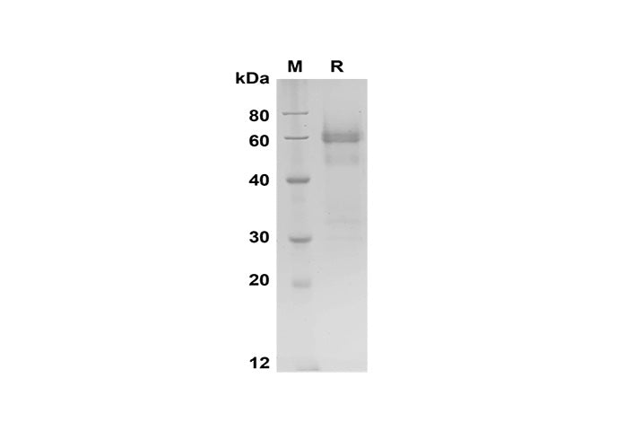 SDS-PAGE analysis of Human OLFM4 proteins, 2 μg/lane of Recombinant Human OLFM4 proteins was resolved with SDS-PAGE under reducing conditions, showing bands at 60-65 kDa.