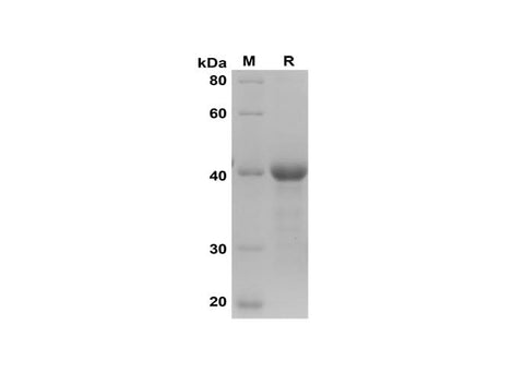 SDS-PAGE analysis of Mouse RAB5B proteins, 2 μg/lane of Recombinant Mouse RAB5B proteins was resolved with SDS-PAGE under reducing conditions, showing bands at 40 kDa.