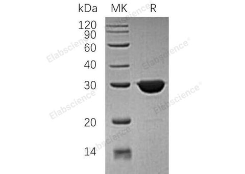 Recombinant Human TPI1/TIM Protein (His Tag) - ABMIUM