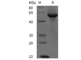 SDS-PAGE analysis of Human G6PD proteins, 2 μg/lane of Recombinant Human G6PD proteins was resolved with SDS-PAGE under reducing conditions, showing bands at 55 kDa.