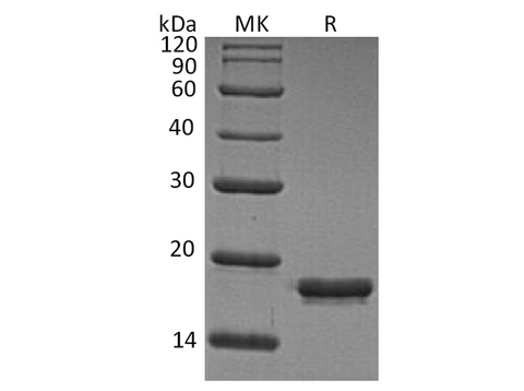 Recombinant Human REG1A/PSPS Protein (His Tag) - ABMIUM