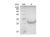 Recombinant Mouse TNFSF4/OX40L Protein (His Tag) - ABMIUM