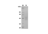 SDS-PAGE analysis of Mouse Factor D/Cfd proteins, 2 μg/lane of Recombinant Mouse Factor D/Cfd proteins was resolved with SDS-PAGE under reducing conditions, showing bands at 38-45 kDa.