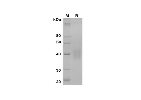 SDS-PAGE analysis of Mouse Factor D/Cfd proteins, 2 μg/lane of Recombinant Mouse Factor D/Cfd proteins was resolved with SDS-PAGE under reducing conditions, showing bands at 38-45 kDa.