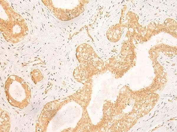 Anti-Human/Mouse/Rat GSG1L Antibody