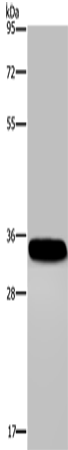 Anti-Human CA4 Antibody - ABMIUM