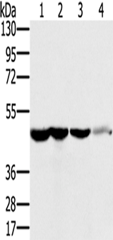 Anti-Human RNH1 Antibody - ABMIUM