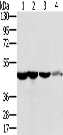 Anti-Human RNH1 Antibody - ABMIUM